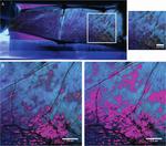 Countcolors, an R package for quantification of the fluorescence emitted by Pseudogymnoascus destructans lesions on the wing membranes of hibernating bats